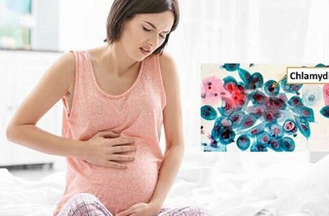 Biến chứng do nhiễm nấm Chlamydia khi mang thai nguy hiểm thế nào?