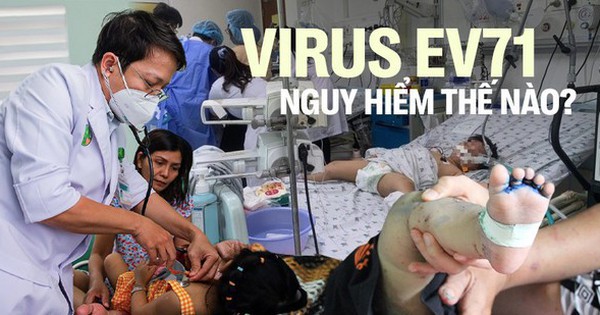 Virus gây bệnh tay chân miệng đã trở lại: EV71 nguy hiểm thế nào?