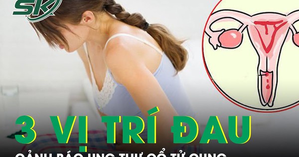 3 vị trí đau cảnh báo ung thư cổ tử cung