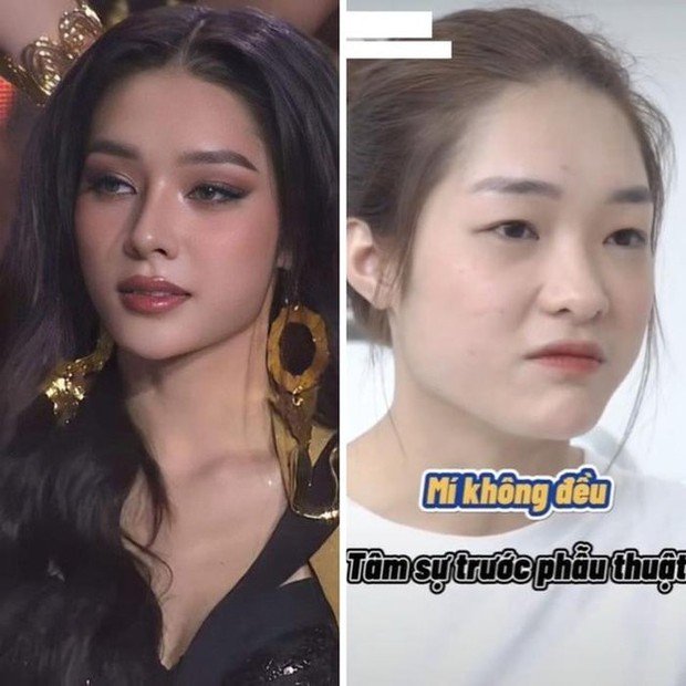 Á hậu Miss Grand Vietnam 2023 đập mặt xây lại: Không nhận ra thời chưa dao kéo, visual hiện tại như mỹ nhân Thái - Ảnh 5.