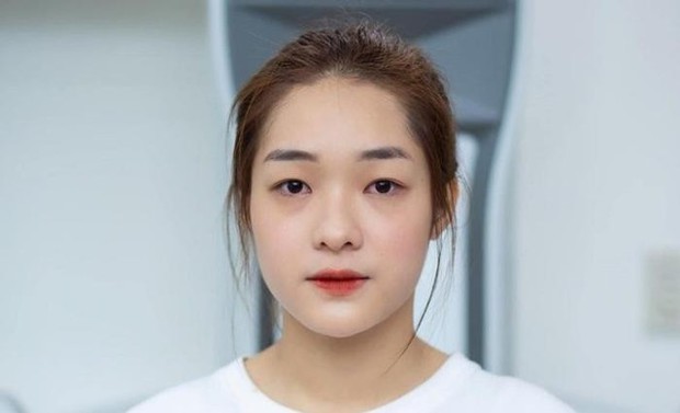 Á hậu Miss Grand Vietnam 2023 đập mặt xây lại: Không nhận ra thời chưa dao kéo, visual hiện tại như mỹ nhân Thái - Ảnh 3.