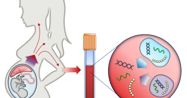 Xét nghiệm huyết thống trước sinh có nguy hiểm cho thai nhi không?