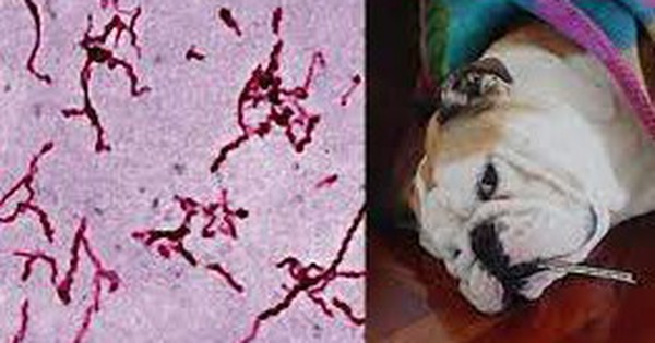 Nhiễm trùng huyết do xoắn khuẩn Leptospira