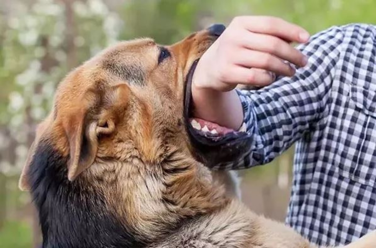 Nhiều trẻ bị chó cắn phải nhập viện, cha mẹ cần biết cách xử trí và phòng bệnh - Ảnh 2.