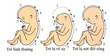 10 thực phẩm giàu acid folic giúp phòng ngừa dị tật bẩm sinh ở thai nhi- Ảnh 1.