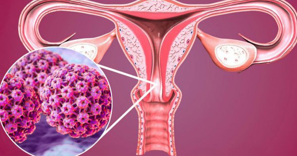 Virus HPV có thể gây những bệnh ung thư nào?