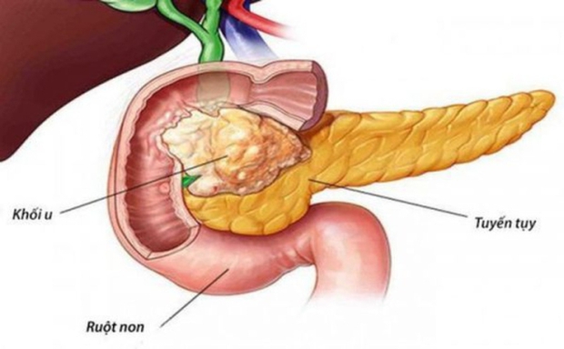 2 món ăn vặt bí mật hủy diệt tuyến tụy của bạn, dù nam hay nữ cũng nên ăn ít đi để phòng bệnh tiểu đường - Ảnh 2.