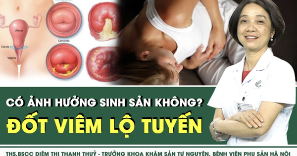 Đốt viêm lộ tuyến cổ tử cung có ảnh hưởng sinh sản không?