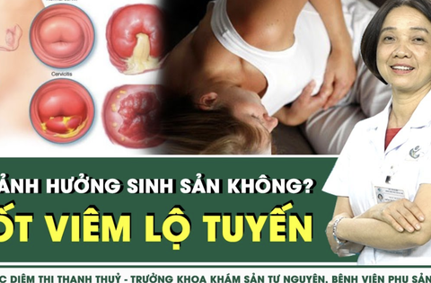 Đốt viêm lộ tuyến cổ tử cung có ảnh hưởng sinh sản không?