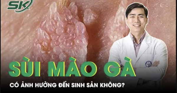 Người từng mắc sùi mào gà có ảnh hưởng đến việc sinh sản không?