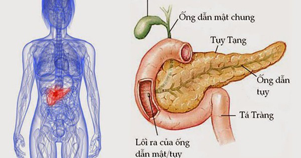 Viêm tụy cấp ở trẻ em: Nguyên nhân, triệu chứng, phòng bệnh và cách điều trị