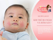 Yêu con - Mùa hè nắng nóng, cách chăm trẻ sơ sinh để da con mát mịn không rôm sảy, đen sạm