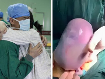 Bà mẹ 9X sinh con nhìn như “thạch rau câu”, chồng hoảng sợ nhưng bác sĩ lại chúc mừng