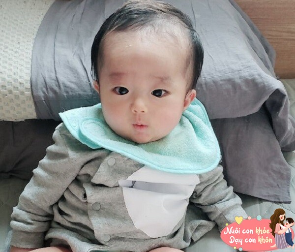 Vầng trán cao và rộng.