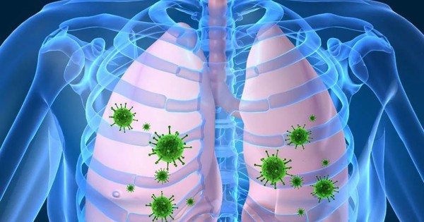 Viêm phổi ở trẻ sơ sinh và những triệu chứng