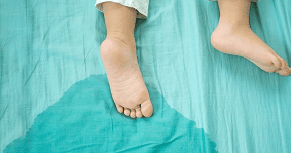 Đái dầm ở trẻ có cần điều trị?