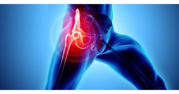 Trẻ sưng đau vùng háng, khó ngồi, cảnh giác với  viêm khớp háng