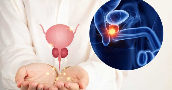 Khi nào nam giới nên tầm soát ung thư tuyến tiền liệt?