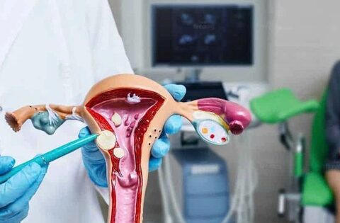 Những câu hỏi thường gặp về bệnh vô kinh