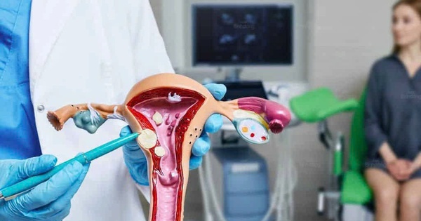 Những câu hỏi thường gặp về bệnh vô kinh