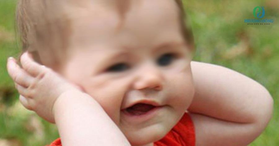 Bé gái 15 tháng tuổi bị liệt dây thần kinh số 7: Thời tiết chuyển lạnh, cảnh báo cha mẹ những dấu hiệu nhận biết