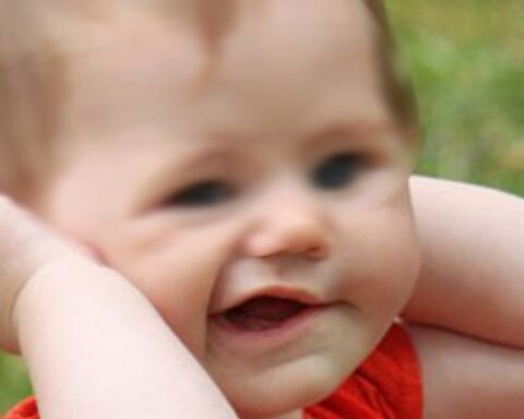 Bé gái 15 tháng tuổi bị liệt dây thần kinh số 7: Thời tiết chuyển lạnh, cảnh báo cha mẹ những dấu hiệu nhận biết