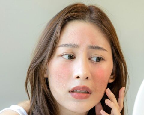 Thời tiết hanh khô, làm gì cho bớt khô da, khô mũi và phòng tránh các bệnh về hô hấp?