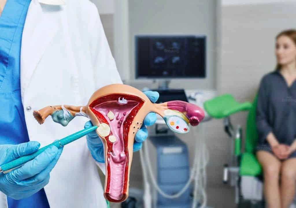 Những câu hỏi thường gặp về bệnh vô kinh- Ảnh 1.