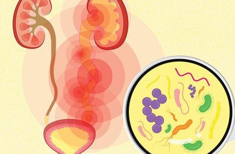 6 đồ uống tốt cho người bị viêm đường tiết niệu