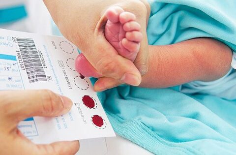 Xét nghiệm lấy máu gót chân ở trẻ sơ sinh phát hiện được bệnh nào?