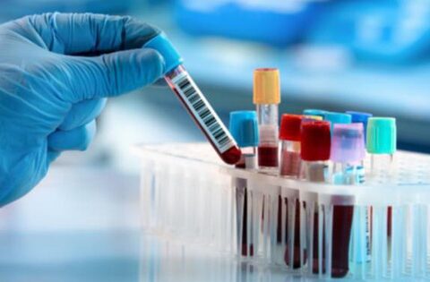 Một xét nghiệm chẩn đoán sớm lạc nội mạc tử cung