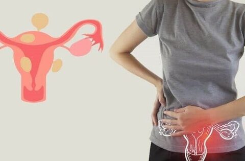 Cách duy trì tình dục lành mạnh khi bị lạc nội mạc tử cung