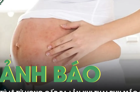 Nguy cơ khi phụ nữ mang thai mắc bệnh sởi