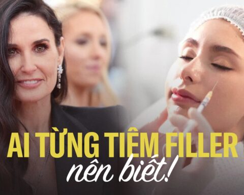Tiêm filler nhiều khiến da bị chùng nhão, liệu bạn có thể cải lão hoàn đồng như các mỹ nhân Hollywood?