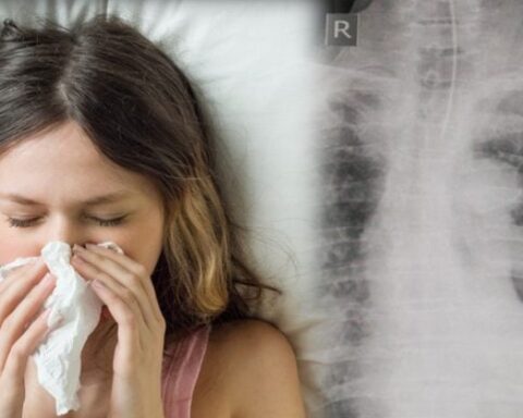 Bệnh cúm có thể giết chết bạn theo những cách nào?