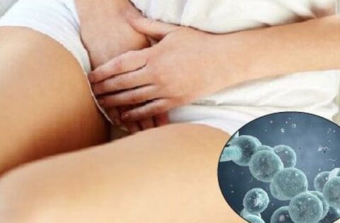 Nhiễm nấm Candida có gây vô sinh?