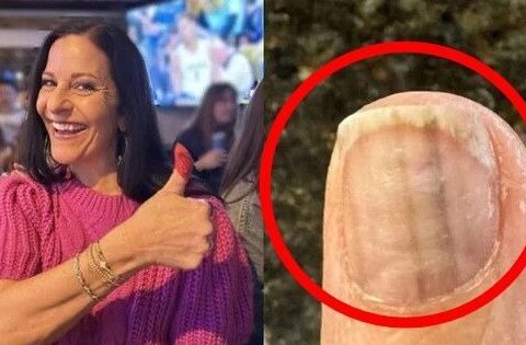 Câu chuyện của người phụ nữ 50 tuổi: Vô tình được cứu mạng khỏi bệnh ung thư từ 1 lần đi làm đẹp