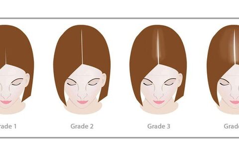 Những lý do rụng tóc thời kỳ mãn kinh và cách cải thiện