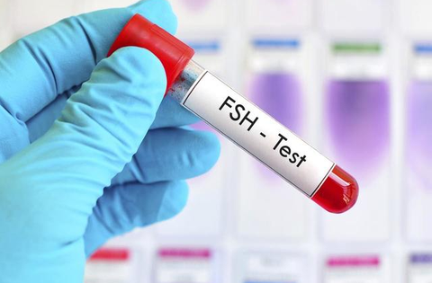 Câu hỏi thường gặp liên quan đến bệnh tắc ống dẫn tinh