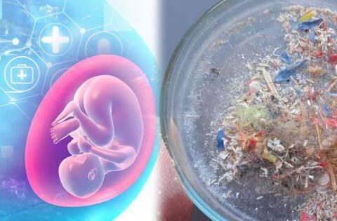 Hạt vi nhựa lần đầu tiên được tìm thấy trong dịch nang buồng trứng của con người
