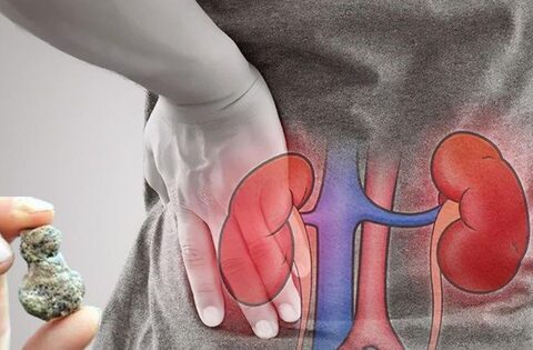 Người giữ 5 thói quen này có nguy cơ cao bị sỏi thận – căn bệnh đau “khủng khiếp” hơn cả sinh con