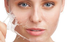 Ưu điểm và rủi ro khi peel da