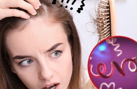 Thấy rụng “tóc” ở 3 vùng này trên cơ thể: Cảnh báo nguy cơ mắc bệnh giang mai