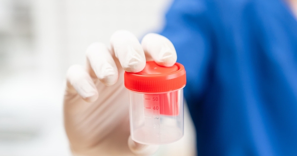 7 thói quen gây hại tinh trùng