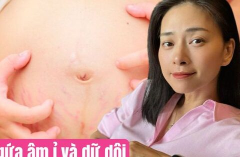 Mang thai ở tuổi 46, Ngô Thanh Vân bị ứ mật trong gan: Biến chứng thai kỳ này đe dọa mẹ và con thế nào?