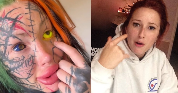 Mạo hiểm xăm nhãn cầu vì muốn thành “nữ thần dị biệt”, nữ người mẫu suýt bị mù: Cảnh báo nghiêm khắc từ chuyên gia