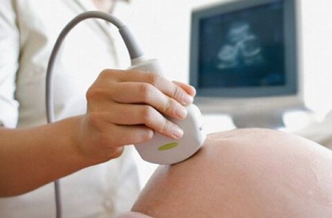 Các mốc siêu âm dị tật thai nhi quan trọng mẹ bầu cần ghi nhớ để có một thai kỳ khỏe mạnh