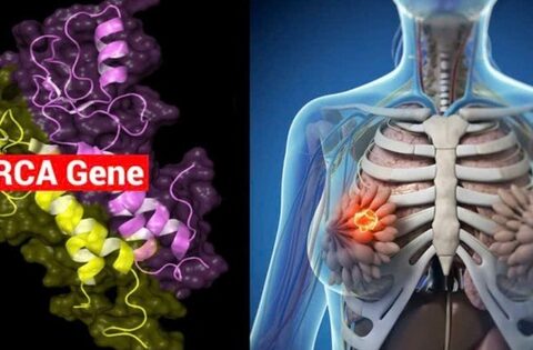 7 yếu tố nguy cơ gây bệnh ung thư vú