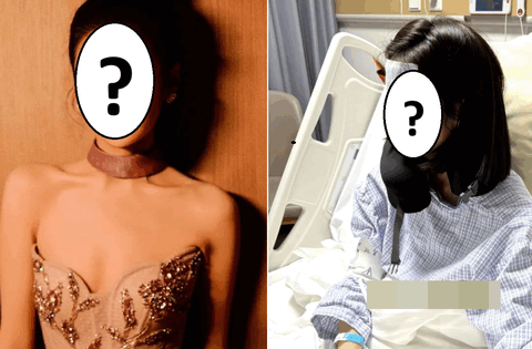 Một nữ diễn viên hạng A phải cắt bỏ túi mật vì sỏi mật, túi mật mất chức năng