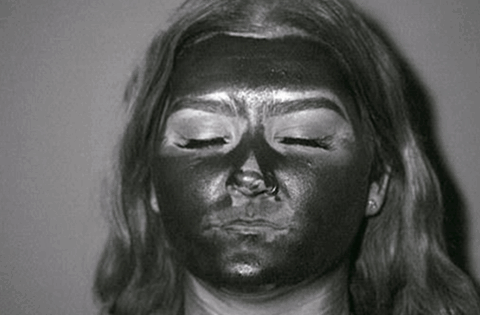 Người phụ nữ mắc ung thư nội mạc tử cung nghi vì sử dụng kem chống nắng?